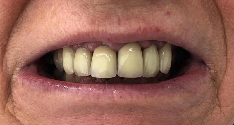 Before Treatment 2