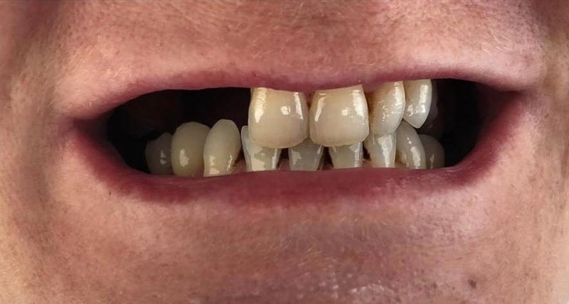 Before Treatment 7