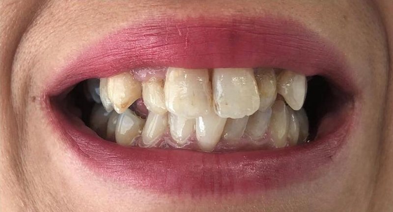 Before Treatment 8