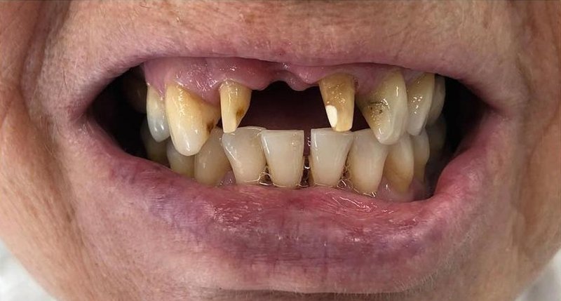 Before Treatment 9