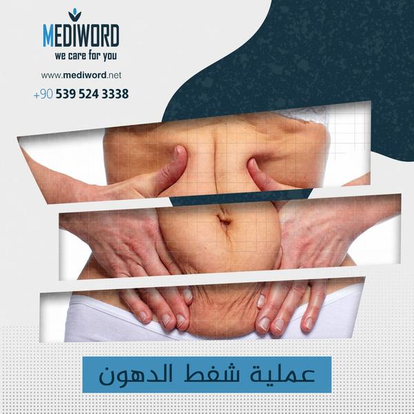 Liposuction